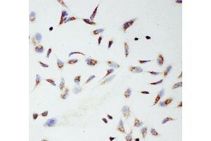 Anti-mtTFA antibody, ICC ICC: HELA Cell (TFAM antibody  (C-Term))