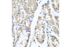 Immunohistochemistry of paraffin-embedded human stomach using TNFAIP6 antibody (ABIN5975410) at dilution of 1/100 (40x lens). (TNFAIP6 antibody)