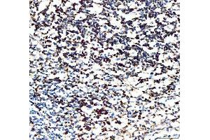 IHC analysis of CD5 using anti-CD5 antibody (ABIN5693203). (CD5 antibody  (AA 25-495))
