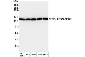 Western Blotting (WB) image for anti-Splicing Factor 3b, Subunit 1, 155kDa (SF3B1) (AA 100-150) antibody (ABIN7452038)