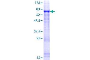NIM1 Protein (AA 1-436) (GST tag)
