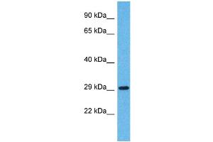 Western Blotting (WB) image for anti-Olfactory Receptor, Family 5, Subfamily H, Member 14 (OR5H14) (C-Term) antibody (ABIN2791756) (OR5H14 antibody  (C-Term))