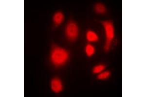 Immunofluorescent analysis of SGK1/2 (pT256/253) staining in HeLa cells. (SGK1/2 (pSer253), (pSer256) antibody)
