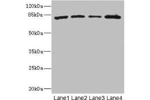 Western blot All lanes: ZP2 antibody at 3. (ZP2 antibody  (AA 651-745))