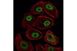 Immunocytochemistry (ICC) image for anti-Structural Maintenance of Chromosomes 1A (SMC1A) antibody (ABIN1844787) (SMC1A antibody)