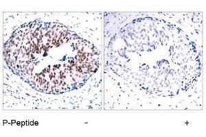 Image no. 1 for anti-Signal Transducer and Activator of Transcription 5A (STAT5A) (pSer780) antibody (ABIN196698) (STAT5A antibody  (pSer780))