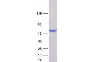 Validation with Western Blot