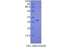 SDS-PAGE of Protein Standard from the Kit (Highly purified E. (alpha 2 Macroglobulin ELISA Kit)