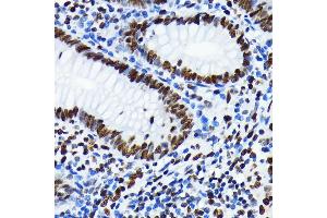 Immunohistochemistry of paraffin-embedded human appendix using Acetyl-Histone H4-K5 antibody (ABIN7267743) at dilution of 1:100 (40x lens). (Histone H4 antibody  (acLys5))