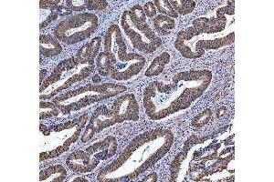 IHC analysis of TRMT6 using anti-TRMT6 antibody (ABIN7602138).