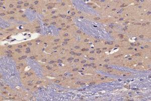 Immunohistochemistry analysis of paraffin-embedded mouse brain using,PSMD8 (ABIN7075226) at dilution of 1: 2600