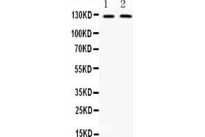 Western blot analysis of CD11b expression in mouse brain extract ( Lane 1) and HEPA whole cell lysates ( Lane 1). (CD11b antibody  (AA 260-360))