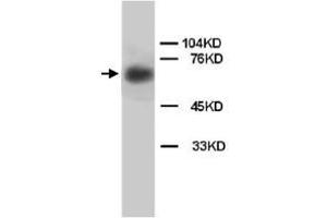 Western Blot analysis of LMNB1 expression from rat brain tissue lyate with LMNB1 polyclonal antibody .