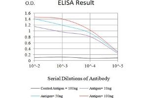 Black line: Control Antigen (100 ng),Purple line: Antigen (10 ng), Blue line: Antigen (50 ng), Red line:Antigen (100 ng) (CTNNB1 antibody  (AA 632-781))