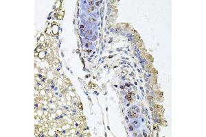 Immunohistochemistry of paraffin-embedded mouse lung using RHOT1 antibody at dilution of 1:100 (x40 lens). (RHOT1 antibody)