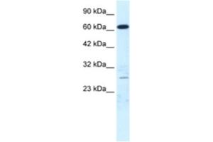 Western Blotting (WB) image for anti-Mediator Complex Subunit 17 (MED17) antibody (ABIN2460890) (MED17 antibody)