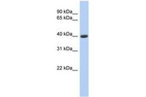 Image no. 1 for anti-Carboxypeptidase B1 (Tissue) (CPB1) (AA 107-156) antibody (ABIN6742411)