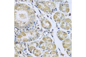 Immunohistochemistry of paraffin-embedded human stomach using PMPCB antibody (ABIN5972414) at dilution of 1/100 (40x lens). (PMPCB antibody)
