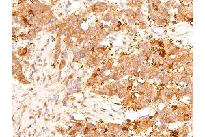 Immunohistochemistry (IHC) image for anti-Tumor Protein P53 (TP53) (pSer15) antibody (ABIN6256151)