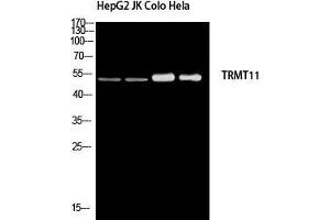 Western Blot (WB) analysis of HepG2 JK Colo HeLa using TRMT11 antibody. (Trmt11 antibody)