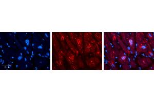 Rabbit Anti-MLX Antibody   Formalin Fixed Paraffin Embedded Tissue: Human heart Tissue Observed Staining: Cytoplasmic, nucleus Primary Antibody Concentration: N/A Other Working Concentrations: 1:600 Secondary Antibody: Donkey anti-Rabbit-Cy3 Secondary Antibody Concentration: 1:200 Magnification: 20X Exposure Time: 0. (MLX antibody  (C-Term))