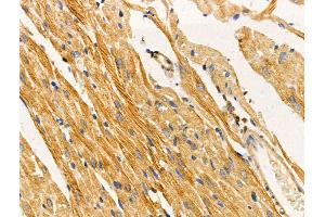 ABIN6258718 and ABIN6274421 at 1/100 staining Rat heart tissue by IHC-P. (TUSC5 antibody  (N-Term))