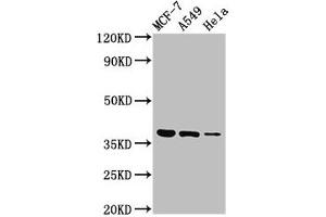 Western Blot Positive WB detected in: MCF-7 whole cell lysate, A549 whole cell lysate, Hela whole cell lysate All lanes: TMEM59 antibody at 3 μg/mL Secondary Goat polyclonal to rabbit IgG at 1/50000 dilution Predicted band size: 37 kDa Observed band size: 37 kDa (TMEM59 antibody  (AA 59-201))