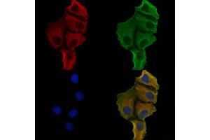 ABIN7094322 and ABIN7098369 staining Hela cells by IF/ICC.
