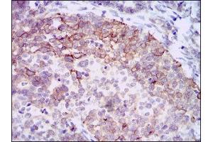 Immunohistochemistry (IHC) image for anti-Hyaluronan Synthase 3 (HAS3) antibody (ABIN1845757) (HAS3 antibody)