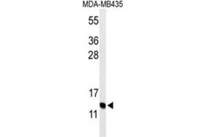 Western Blotting (WB) image for anti-Gonadotropin-Releasing Hormone 2 (GnRH2) antibody (ABIN3004318)