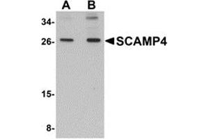 Western Blotting (WB) image for anti-Secretory Carrier Membrane Protein 4 (SCAMP4) (C-Term) antibody (ABIN1030644) (SCAMP4 antibody  (C-Term))