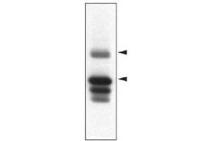 Western blot analysis of Ptpn5 in striatal rat protein homogenates using Ptpn5 monoclonal antibody, clone 23E5  .