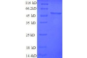 Protein expressed in E. (ENO1 Protein (AA 2-433, partial) (His tag))