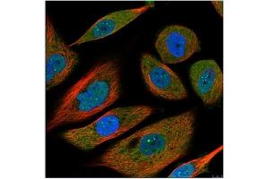 Image no. 1 for anti-Interleukin 6 (IL6) antibody (ABIN181727) (IL-6 antibody)