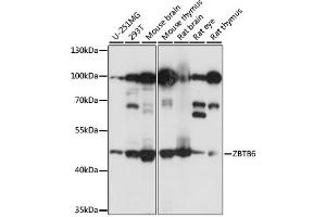 Western blot analysis of extracts of various cell lines, using ZBTB6 antibody. (ZBTB6 antibody)