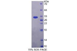 SDS-PAGE (SDS) image for Rhotekin (RTKN) (AA 296-548) protein (His tag) (ABIN4989526) (Rhotekin Protein (RTKN) (AA 296-548) (His tag))