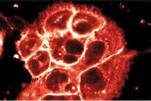 Immunofluorescent staining of A431 cells. (P-Cadherin antibody  (AA 72-259))
