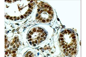 ABIN184704 (4µg/ml) staining of paraffin embedded Human Breast. (APEX1 antibody  (N-Term))