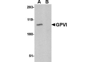 Western Blotting (WB) image for anti-Glycoprotein VI (Platelet) (GP6) (C-Term) antibody (ABIN1030419)