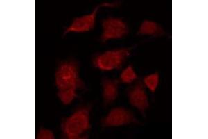 ABIN6269047 staining COS7 by IF/ICC. (IKBKB antibody)