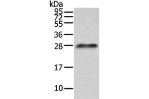 Gel: 12 % SDS-PAGE, Lysate: 40 μg, Lane: Human plasma solution, Primary antibody: ABIN7191260(Lambda Light chain Antibody) at dilution 1/200 dilution, Secondary antibody: Goat anti rabbit IgG at 1/8000 dilution, Exposure time: 10 seconds (IGLV1-51 antibody)