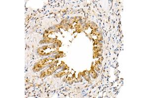 Immunohistochemistry of paraffin-embedded rat lung using  Rabbit pAb (ABIN7265581) at dilution of 1:350 (40x lens). (ANAPC2 antibody  (AA 400-500))