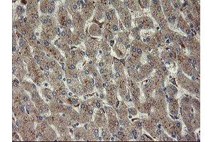 Immunohistochemical staining of paraffin-embedded Human liver tissue using anti-CHN1 mouse monoclonal antibody. (CHN1 antibody)