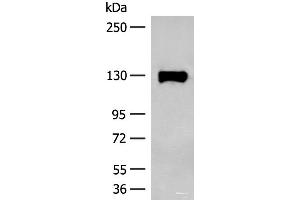 Western blot analysis of Human prostate tissue lysate using SENP6 Polyclonal Antibody at dilution of 1:200 (SENP6 antibody)