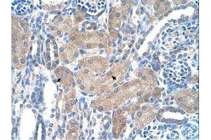 Image no. 1 for anti-Sep (O-phosphoserine) tRNA:Sec (Selenocysteine) tRNA Synthase (SEPSECS) (AA 61-110) antibody (ABIN6736318) (SEPSECS antibody  (AA 61-110))