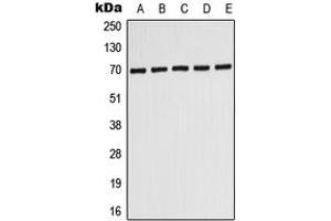 Western blot analysis of ABCD3 expression in HepG2 (A), MCF7 (B), SHSY5Y (C), SP2/0 (D), PC12 (E) whole cell lysates.