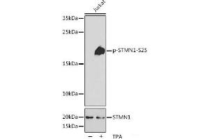 Western blot analysis of extracts of Jurkat cells using Phospho-STMN1(S25) Polyclonal Antibody at dilution of 1:2000. (Stathmin 1 antibody  (pSer25))