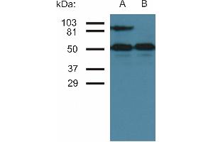 Western blottin analysis of CD54 expression in TNF-alpha activated (A) and nonactivated (B) HUVEC cells by antibody MEM-111. (ICAM1 antibody)