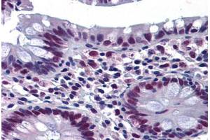 Human Colon: Formalin-Fixed, Paraffin-Embedded (FFPE) (CHEK2 antibody  (AA 1-544))