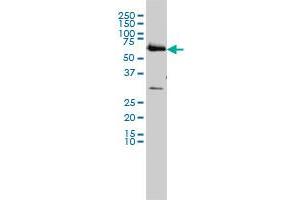 CCT6B monoclonal antibody (M01), clone 1A4 Western Blot analysis of CCT6B expression in HL-60 . (CCT6B antibody  (AA 1-530))